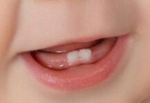 Могут ли зубы прорезываться без боли: лайфхаки для мам