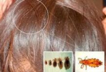 Австралийские ученые обнаружили потенциальное лекарство от коронавируса