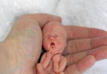 Прервать жизнь: какие виды абортов существуют