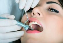 Способы и преимущества пломбирования зубов