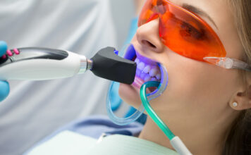 Способы и плюсы клинического отбеливания зубов