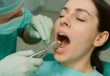 Сложное удаление постоянных зубов: что это такое и в каких случаях требуется